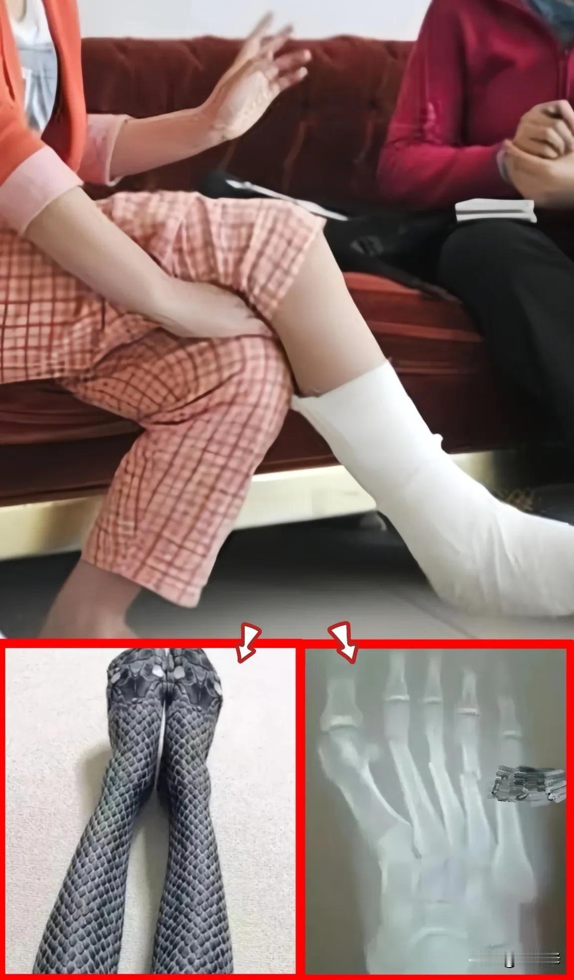 一女子为讨丈夫欢心，在网上购买了一件蛇皮情趣内衣，万万没想到关键时刻悲催了，“丝