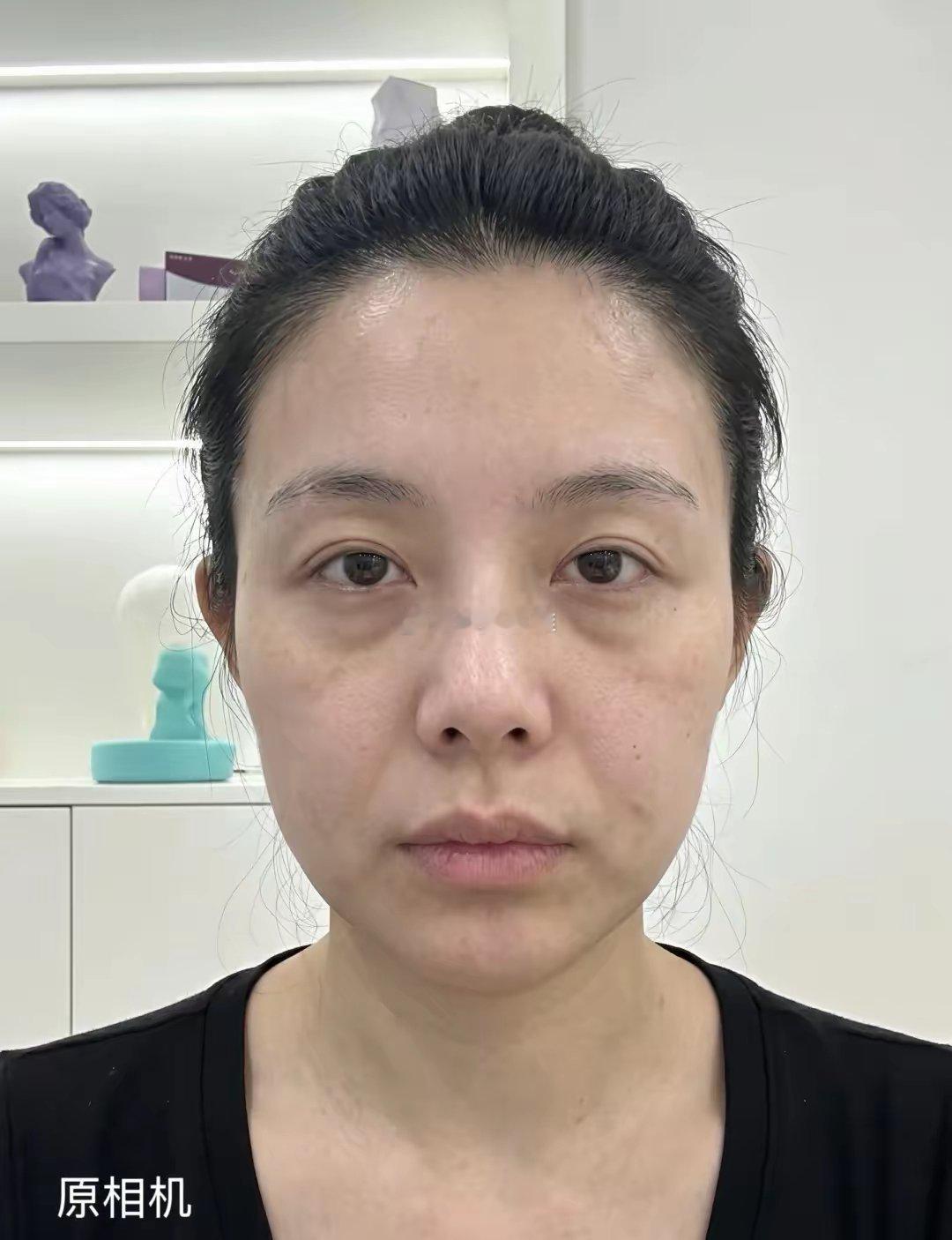 跑了三趟终于从左到右了都说现在好看的像换了一个人 