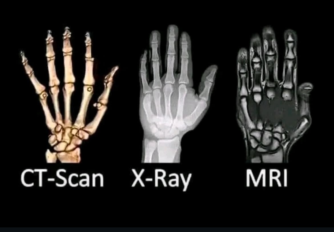 不同损伤拍什么片子 3种不同的医学影像学检查方法：CT扫描（CT-Scan）、X