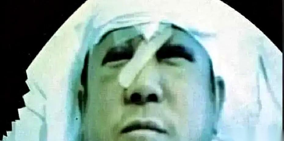 脑袋上硬生生缝了29针，纱布底下还渗着血水。
48岁、平时在圈里呼风唤雨的老大哥