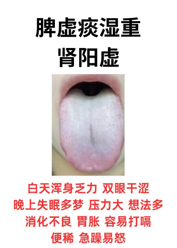 身体总调理不好？先分清你是哪种脾肾亏虚