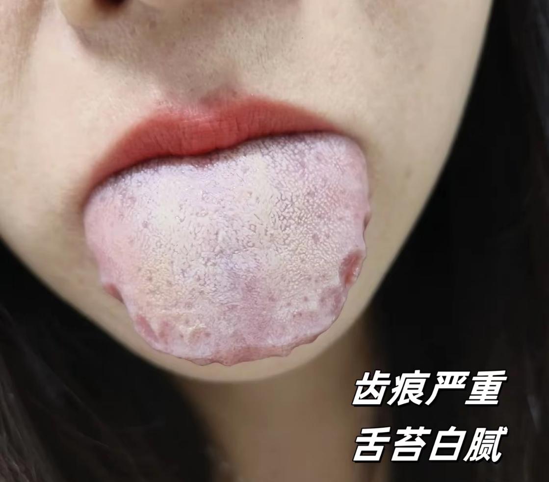 评论区看到的舌头，可不太妙了，调着真费劲[吐彩虹]
爱发脾气，整天没精神，困的不