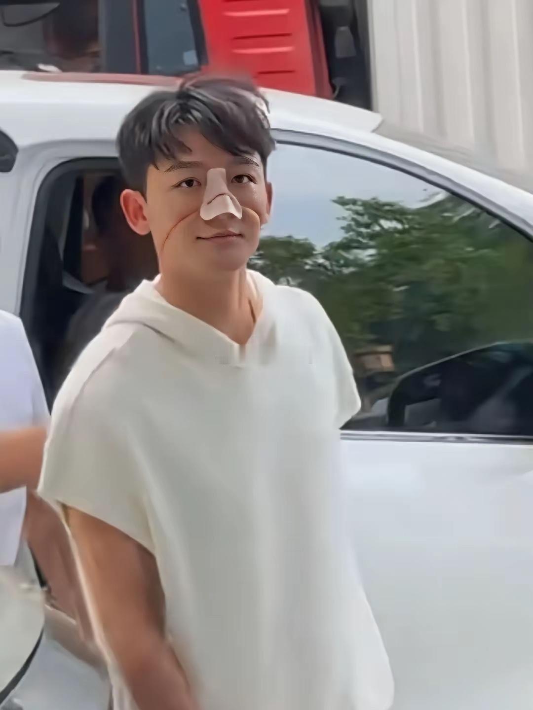 张晚意这鼻子看起来好严重啊 