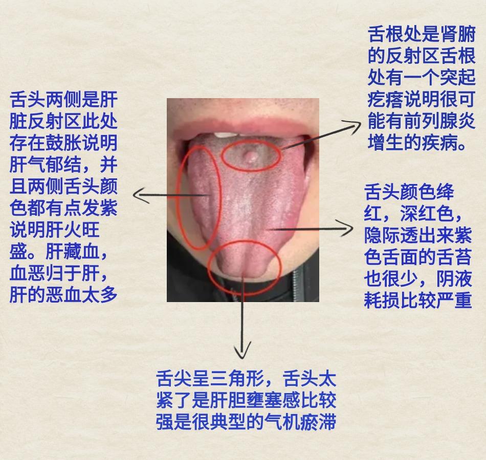 今日份患者舌象案例分析