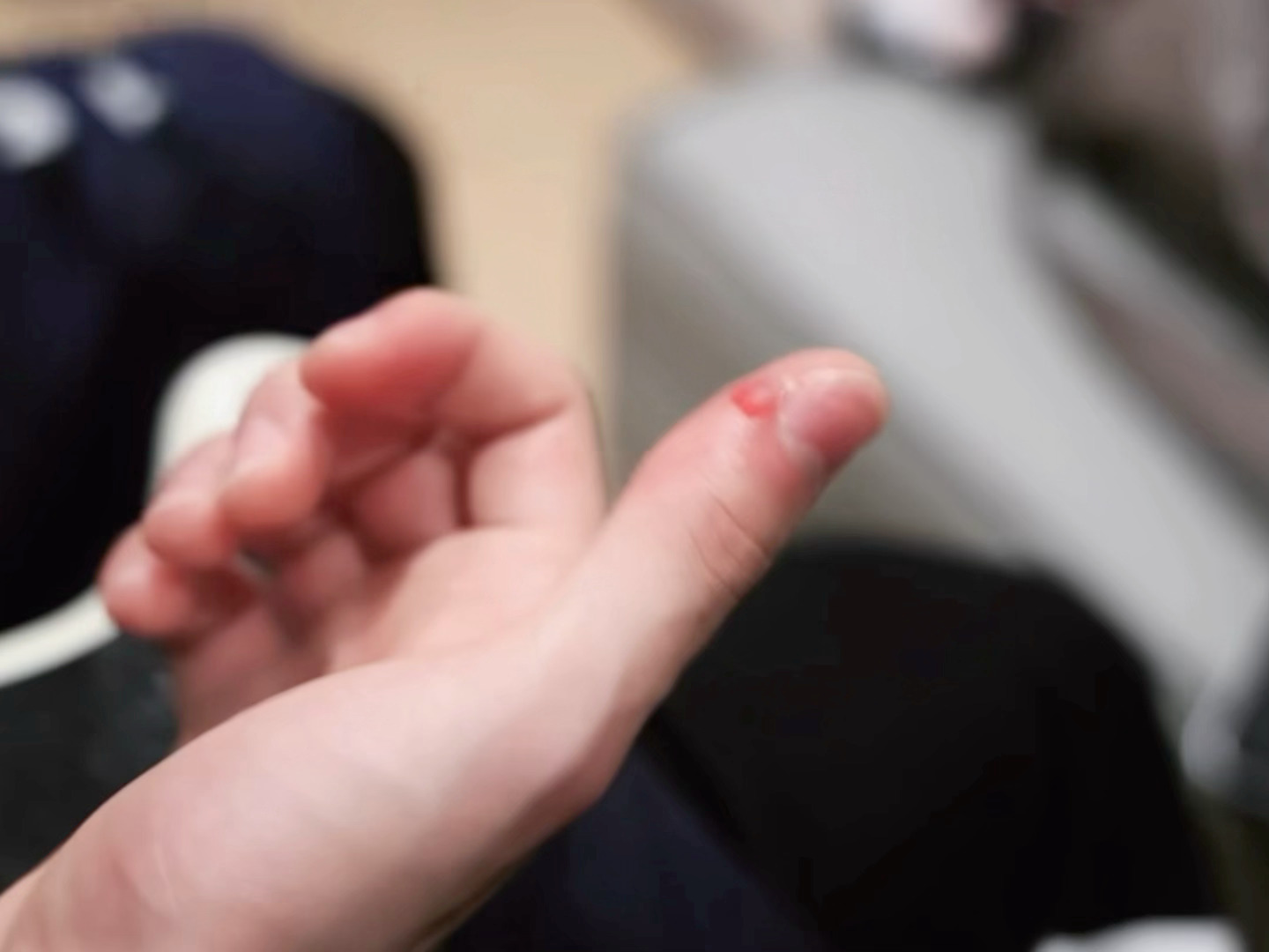 天啊 所以被磨到流血之后裹上创可贴继续练习 感觉超级痛的…… 