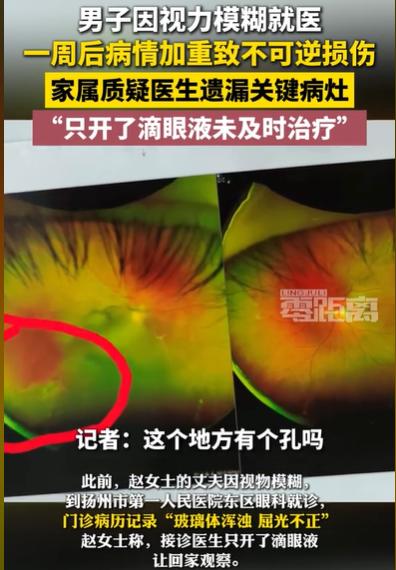 江苏扬州，男子因为视力模糊到医院做检查，当时检查就显示，玻璃体混浊，屈光不正，已