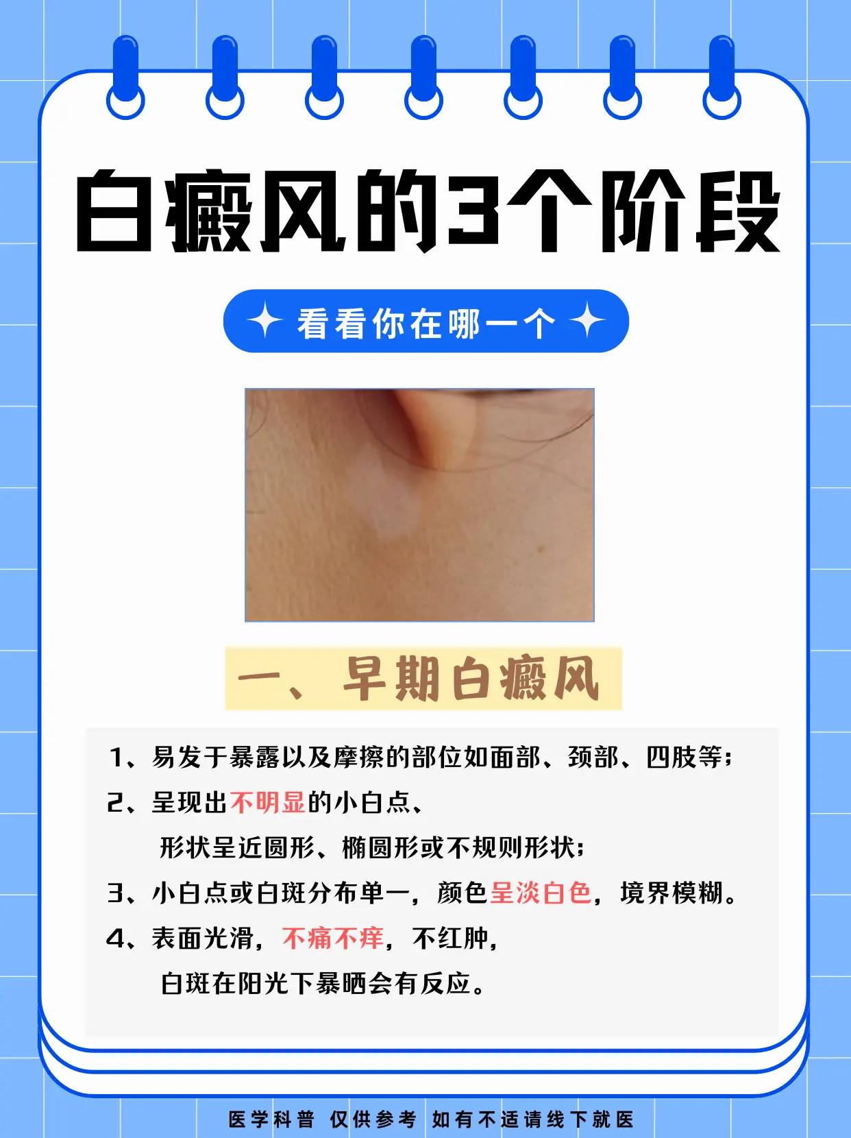 医学科普 白癜风 白斑 硬核健康科普行动  皮肤健康