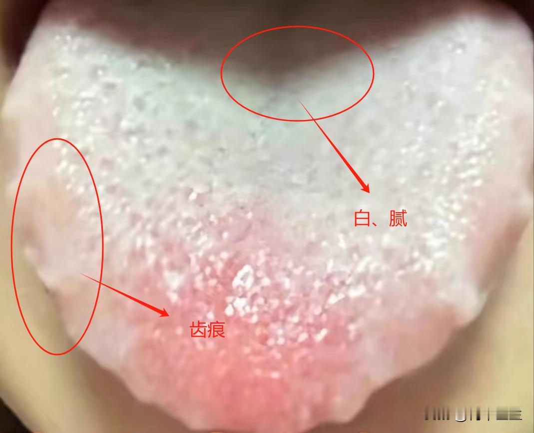 脸上长斑别在不以为意了，可能是脾胃在发出警告

今天看了一位患者，脸上皮肤上星星