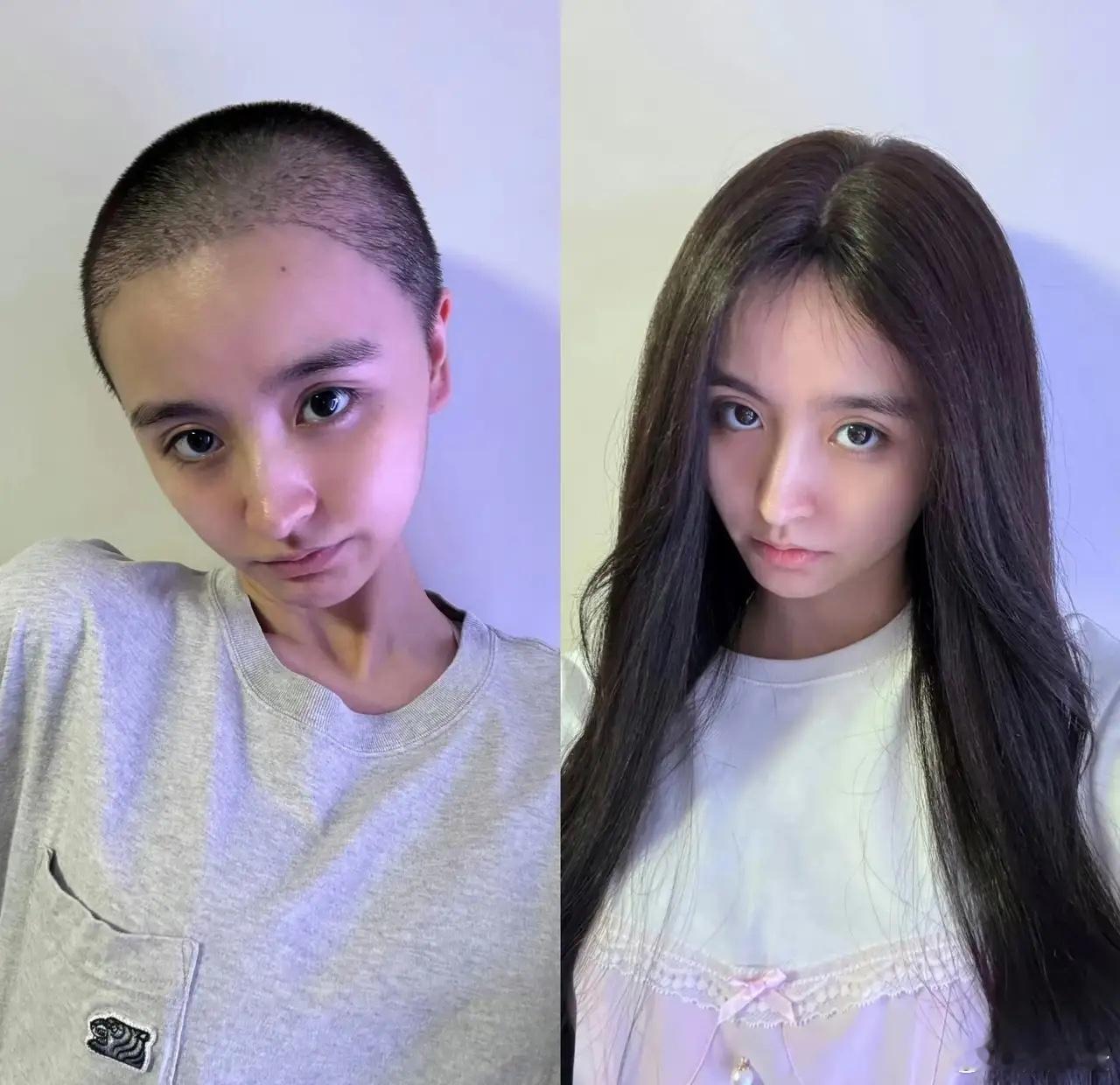 天呐，女爱豆退圈后居然剃了光头，可见娱乐圈的压力得有多大啊，真让人心疼！就说金子
