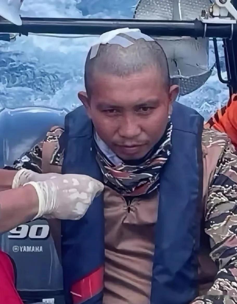 这位就是被中国海警敲破脑袋的菲律宾军人，现在竟被他们捧成英雄了。  

不过是擦