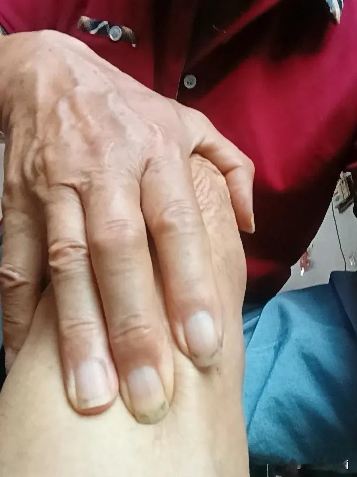 如何去找足三里的穴位? 找足三里穴位其实不难。足三里在小腿外侧，是个重要穴位，能
