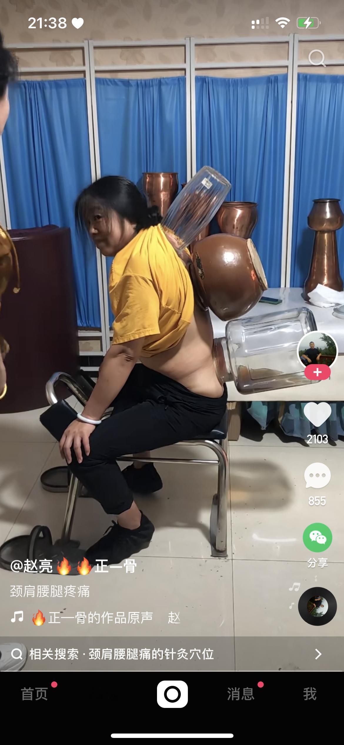 惊了 ……这是拔罐？ ​​​