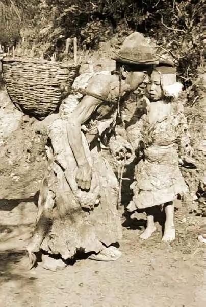 解放前西藏的农奴有多惨
​解放前西藏农奴，是人间地狱般的生存状态，被称为“会说话