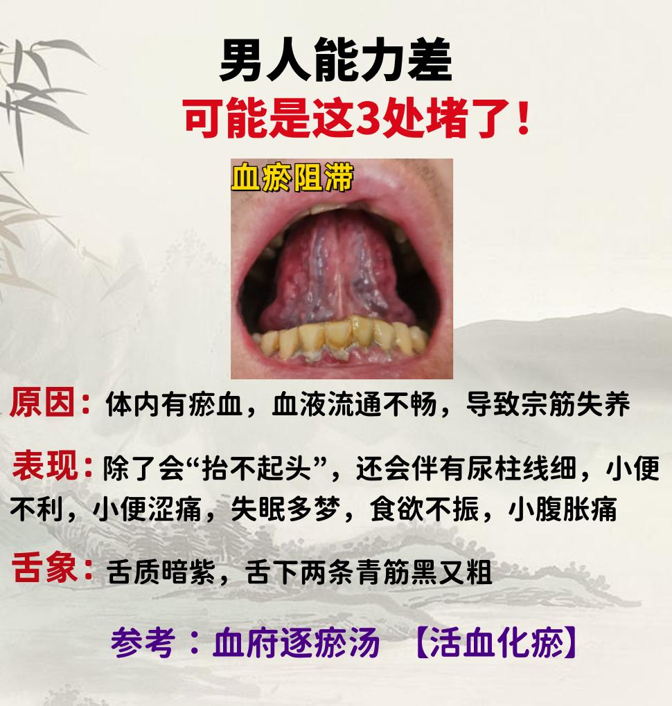 男人能力差，可能不是肾虚，而是这3处堵了！

1.血瘀阻滞
2.肝经淤堵
3.下