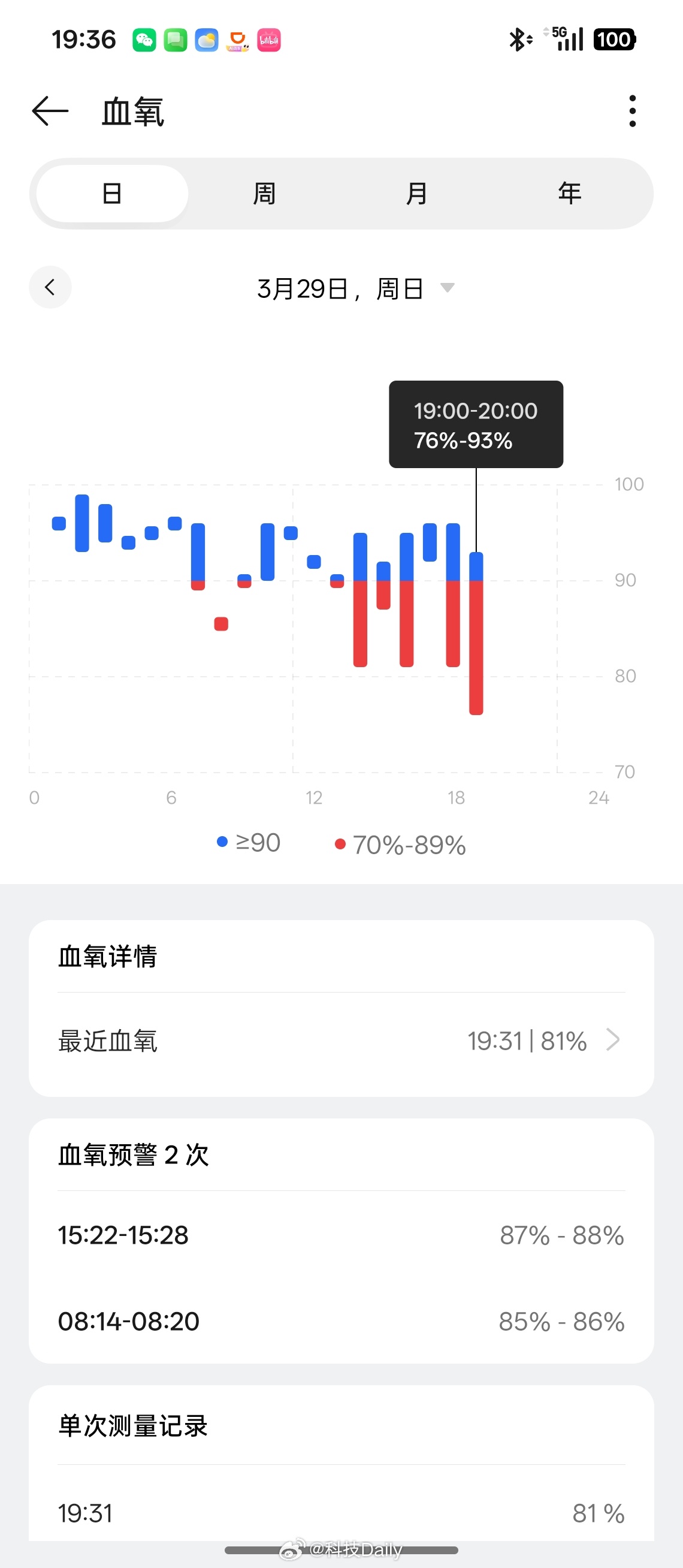 这次来丽江竟然高反了，头又疼了一下午然后直接睡着了。最低血氧到了76%，都没看见