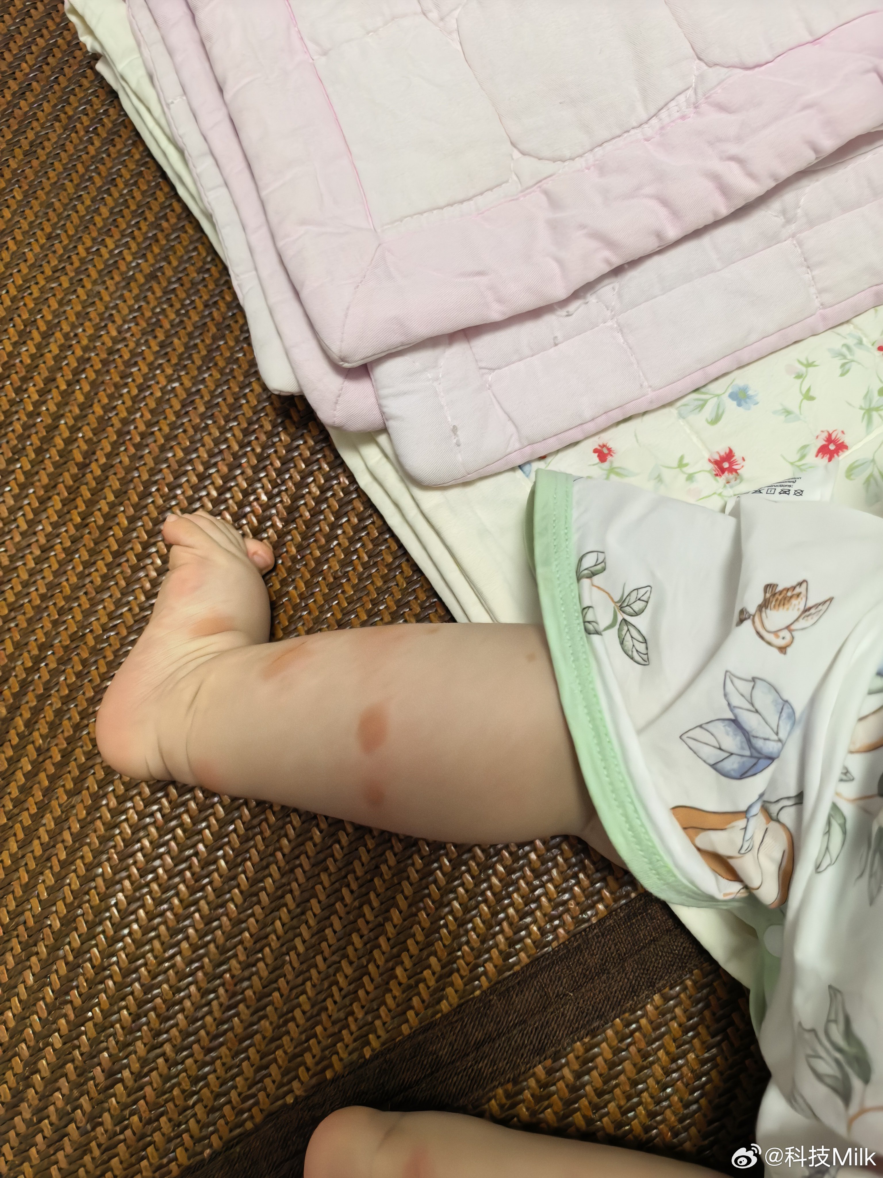 姐弟俩被蚊子叮得不成样子了，实在是每天出去就贴防蚊贴也没啥用。姐姐还不愿意穿长裤