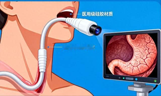 消化科主任：复查肠胃，只查胃镜就废了，胃病必查的 6 项指标
