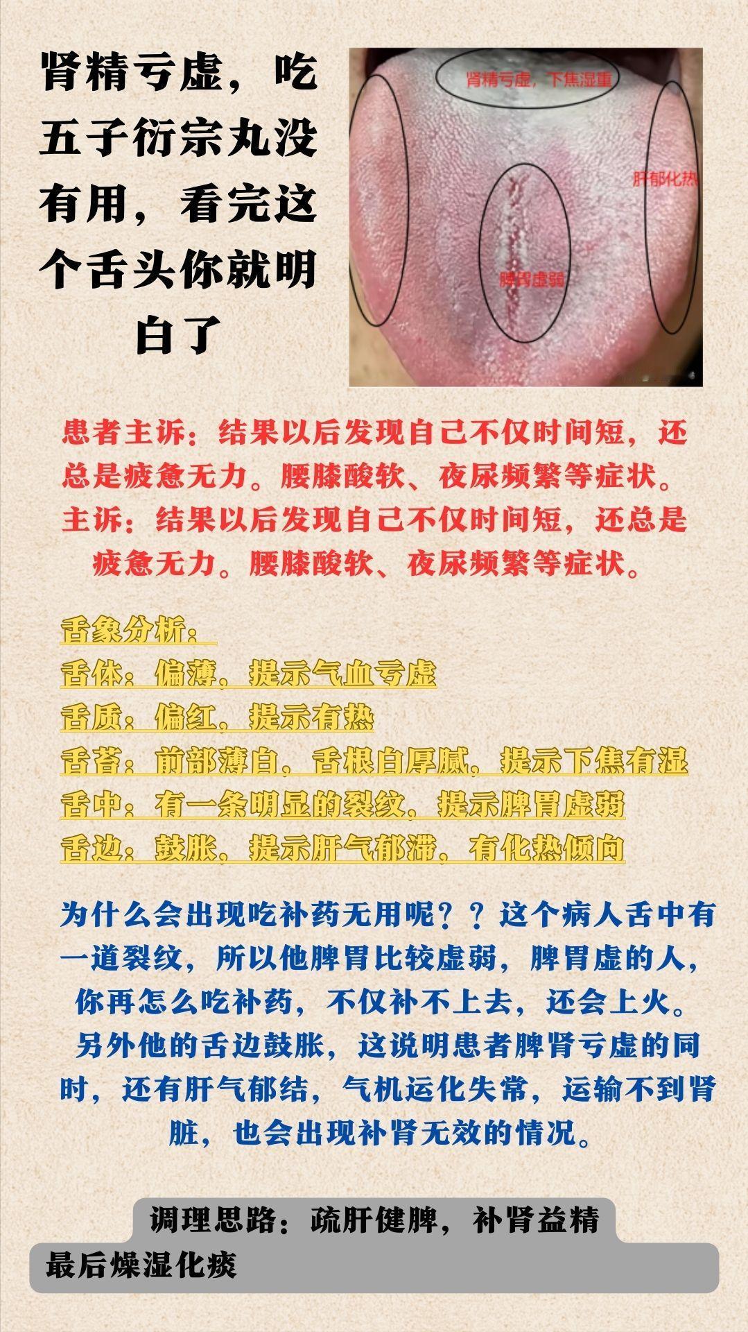 这种裂纹舌象，脏腑脾胃虚弱，肾精亏虚，肝气郁结总是疲惫无力。
腰膝酸软、夜尿频繁