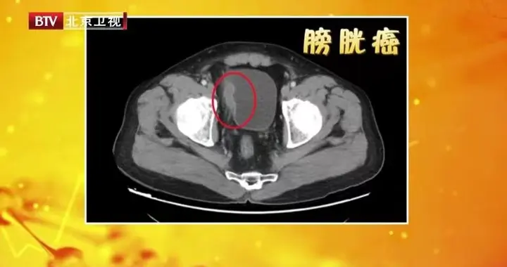 睡觉出现这5种表现，可能是“寿命警报”！别当成小毛病忽略了