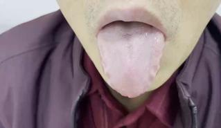 舌象是人体内脏腑气血状态的一面镜子，这张照片提供了非常典型和清晰的辨证信息。舌体
