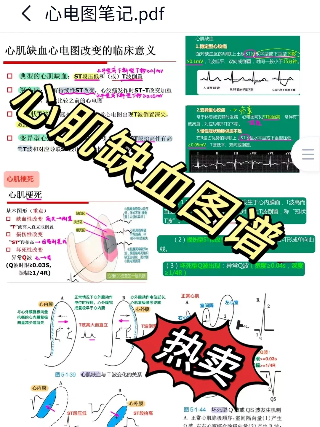 难倒了多少医学生的心电图🔥！！