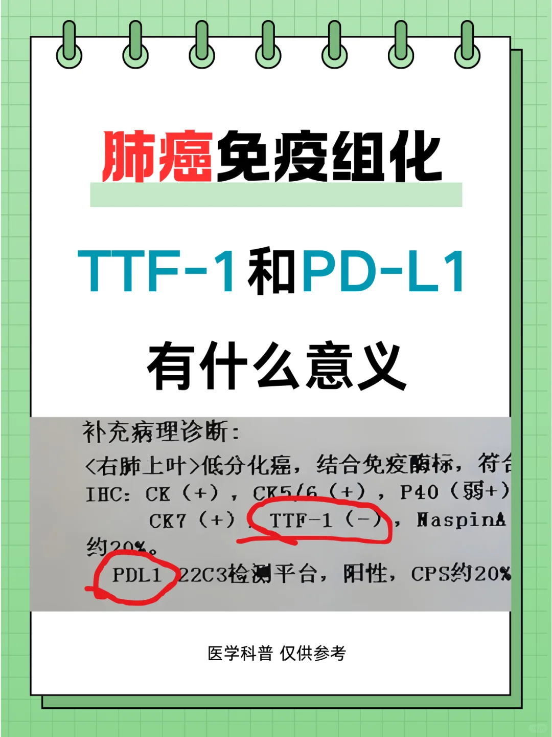 肺癌免疫组化中的TTF-1和PD-L1能看出什么？