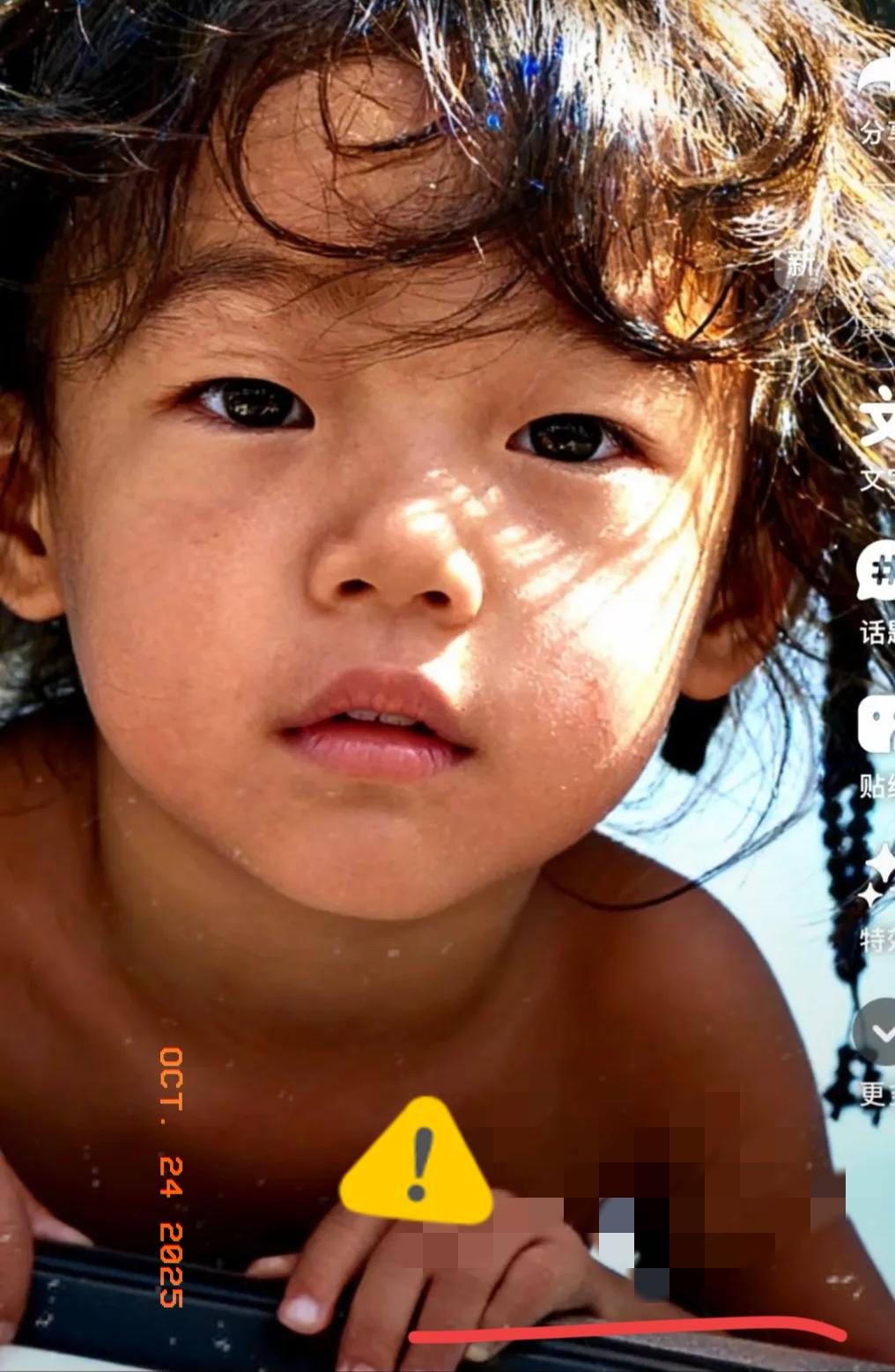 云南icon这个孩子太可怜了，呼吁大家一起救救这个孩子吧太可怜了，她本是一个很正
