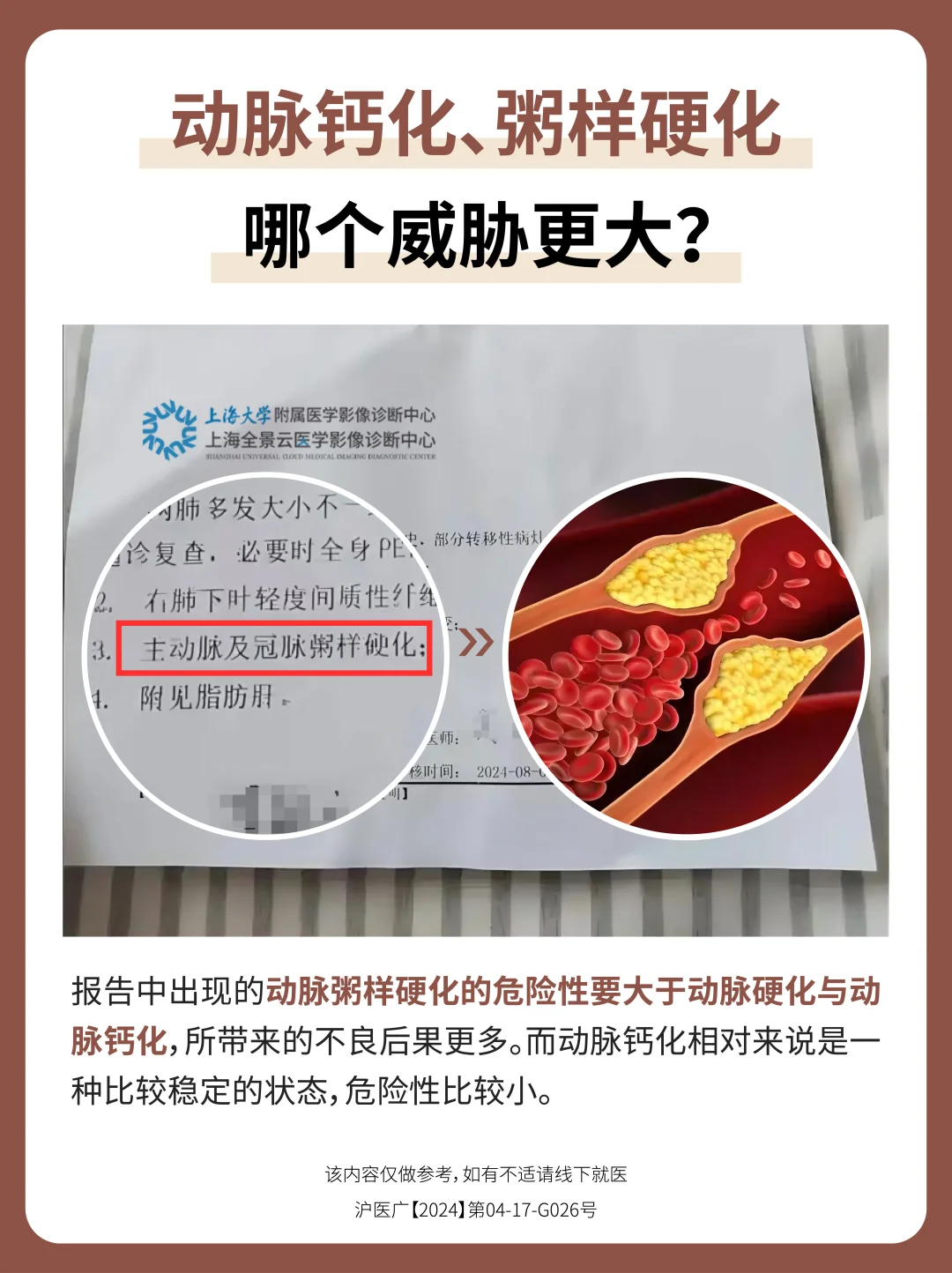 动脉钙化、粥样硬化，哪个威胁更大⚠️