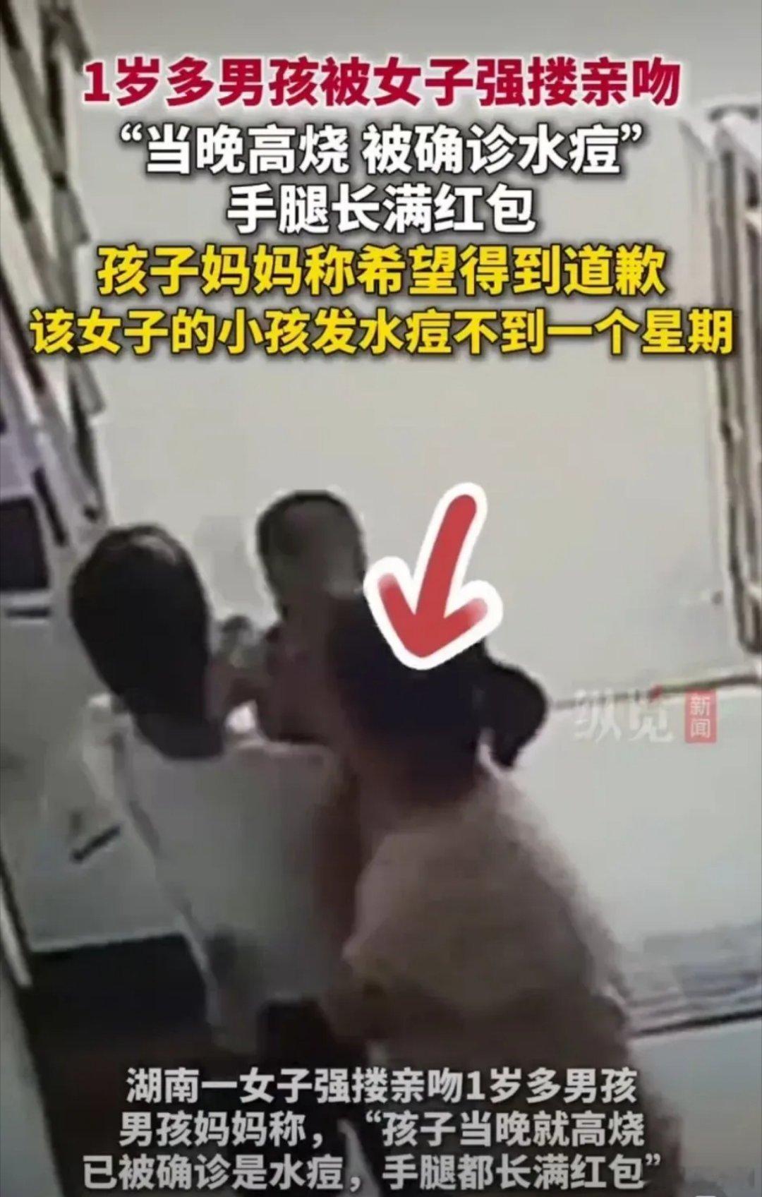被女子强搂亲吻男孩妈妈愤怒回应明知自己小孩刚得水痘一个星期还强吻邻居家小孩，造成