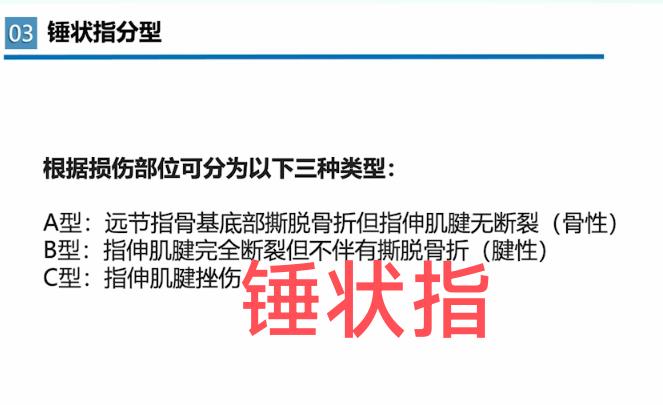 锤状指☞。指伸肌腱超声