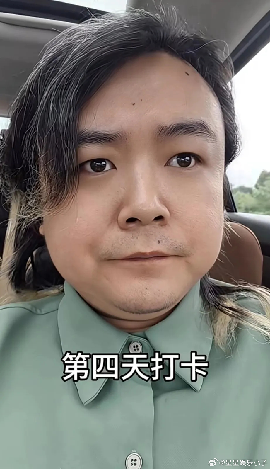 王照达导演：以前觉得一夜白头很夸张，没想到这几天白了这么多头发，这是为什么呢？ 