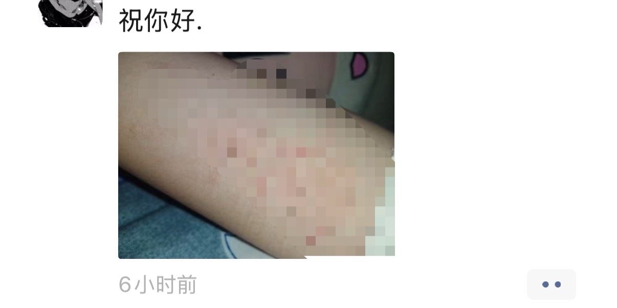 大姐以为自己配个伤感文案，放张自残图很酷吗？