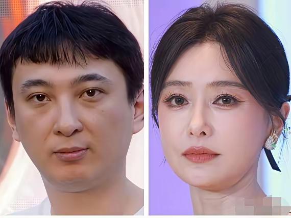 王思聪秦岚合伙医美，是任性还是商机？
 
没想到啊，王思聪回国后竟和秦岚一起开起