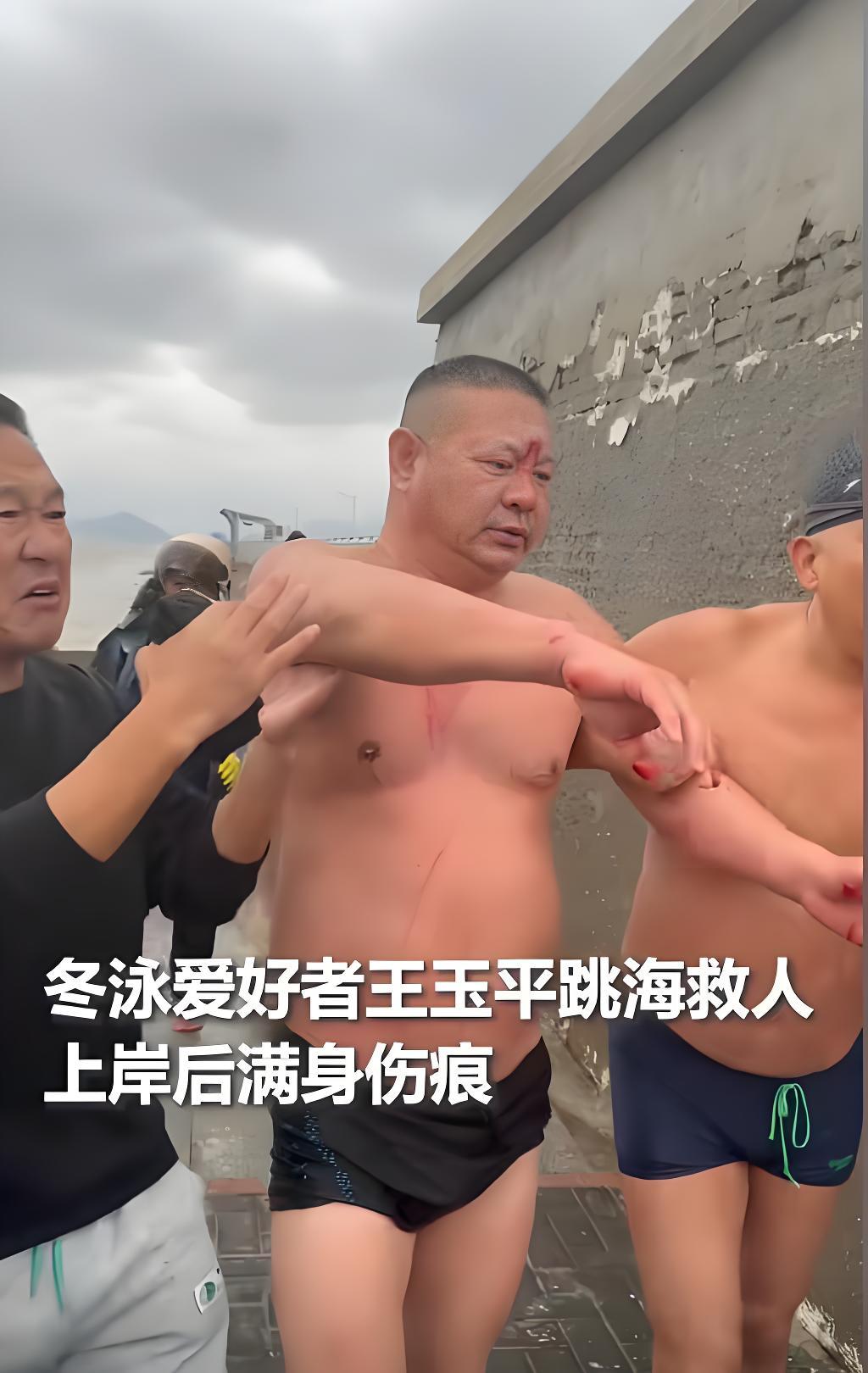 连云港市民浑身是伤，风浪中换回一条命！江苏连云港冬泳爱好者王玉平在巨浪和礁石遍布