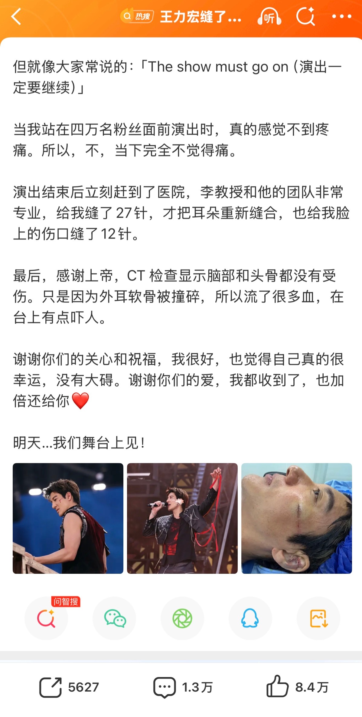 王力宏缝了39针王力宏事故责任人员被调查 王力宏昨晚带伤坚持，耳朵和侧脸缝了39