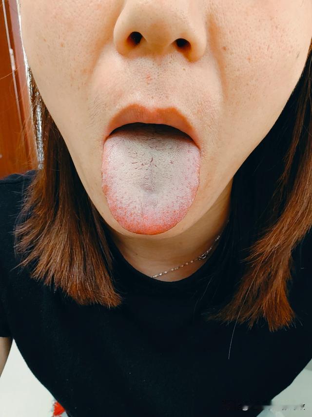 这么漂亮一个大美女，奈何妇科问题缠身，问题一堆[捂脸][捂脸][捂脸]
主诉：妇