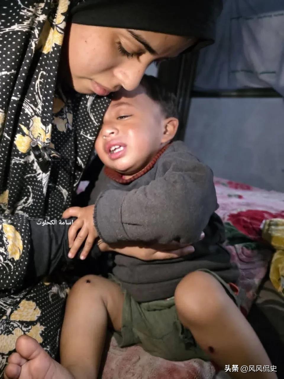 据土耳其国家公共广播公司：以色列士兵在加沙对一名一岁儿童施以酷刑，包括用香烟烫伤