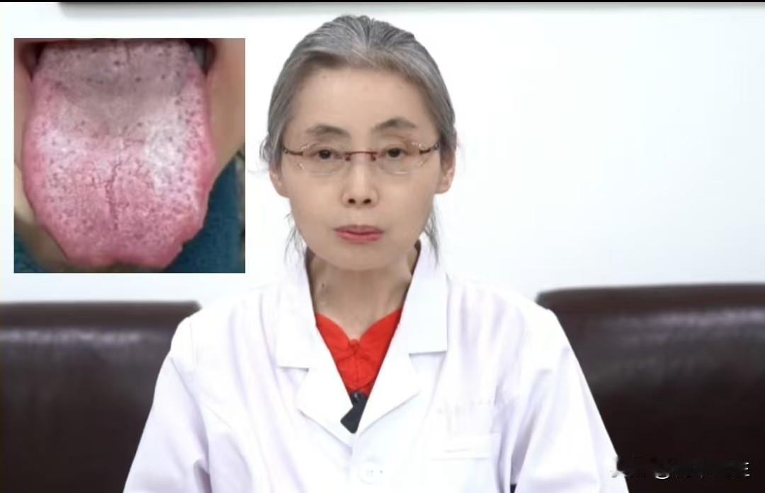 出现这样的舌头，男科问题少不了！

患者主诉：草草了事，时间很短，战斗力差，同房