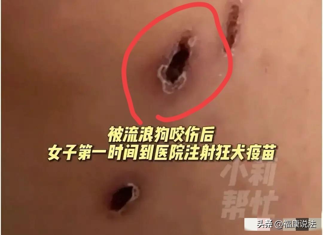 “悲剧还是发生了！”河南焦作，女子家门半开，一流浪狗尾随人进入，女子下楼撵狗，狗