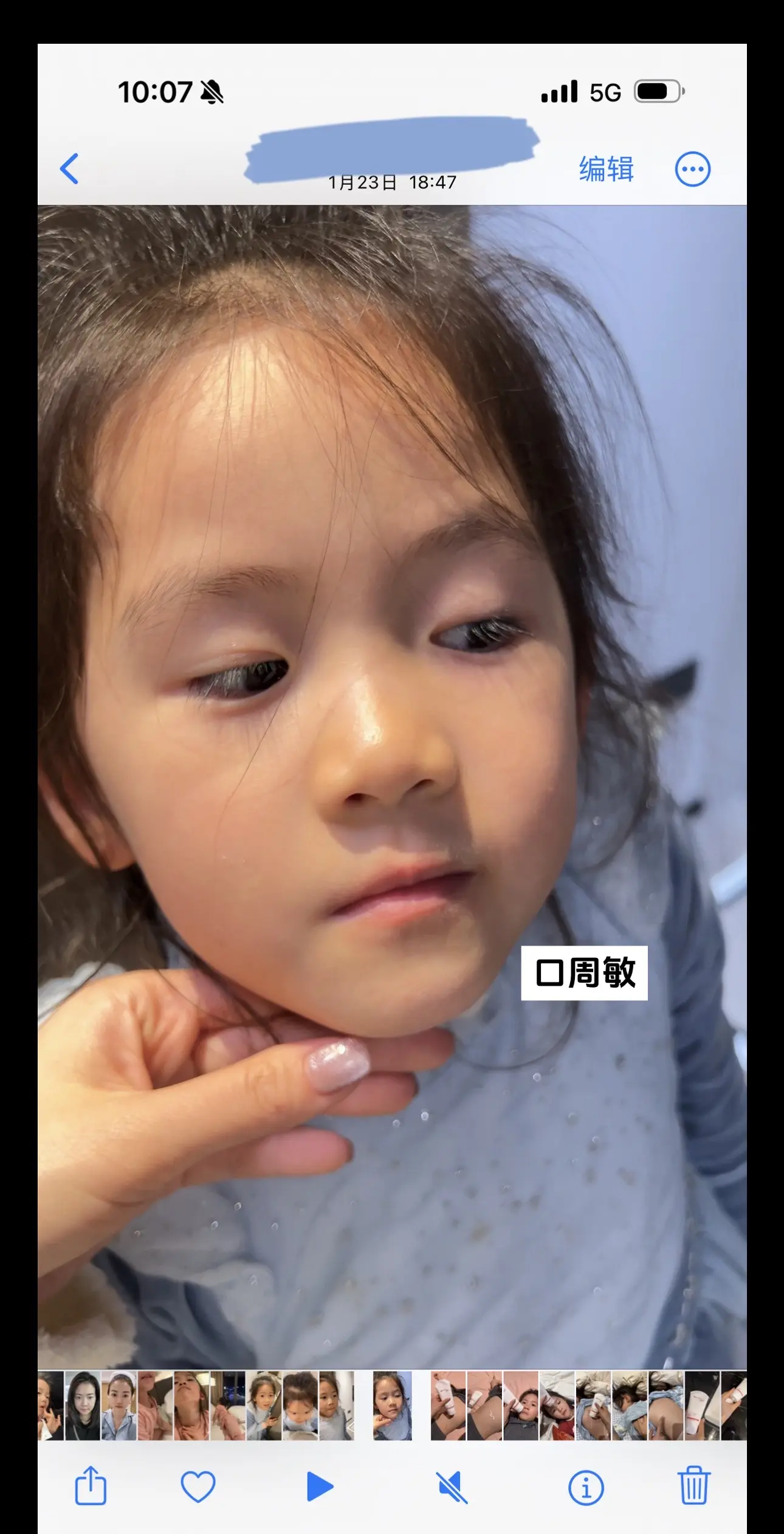 从小大敏宝，变成发光女孩 坚持不懈舒润霜…