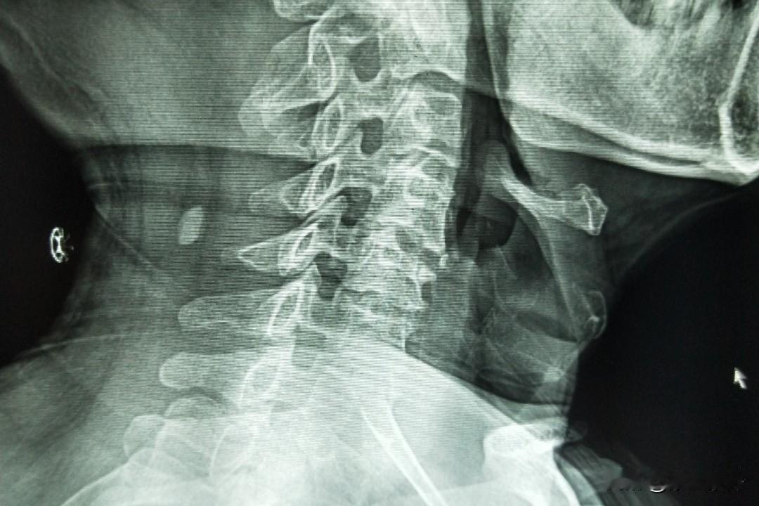 摸了30年的电脑，我又拿起了笔杆子

30年电脑工作，
让我的颈椎早已病变，
强