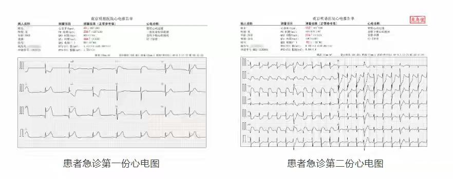 39岁男子酒后急性心梗心脏骤停！南京明基医院多学科联手跑赢死神

39岁男子酒后