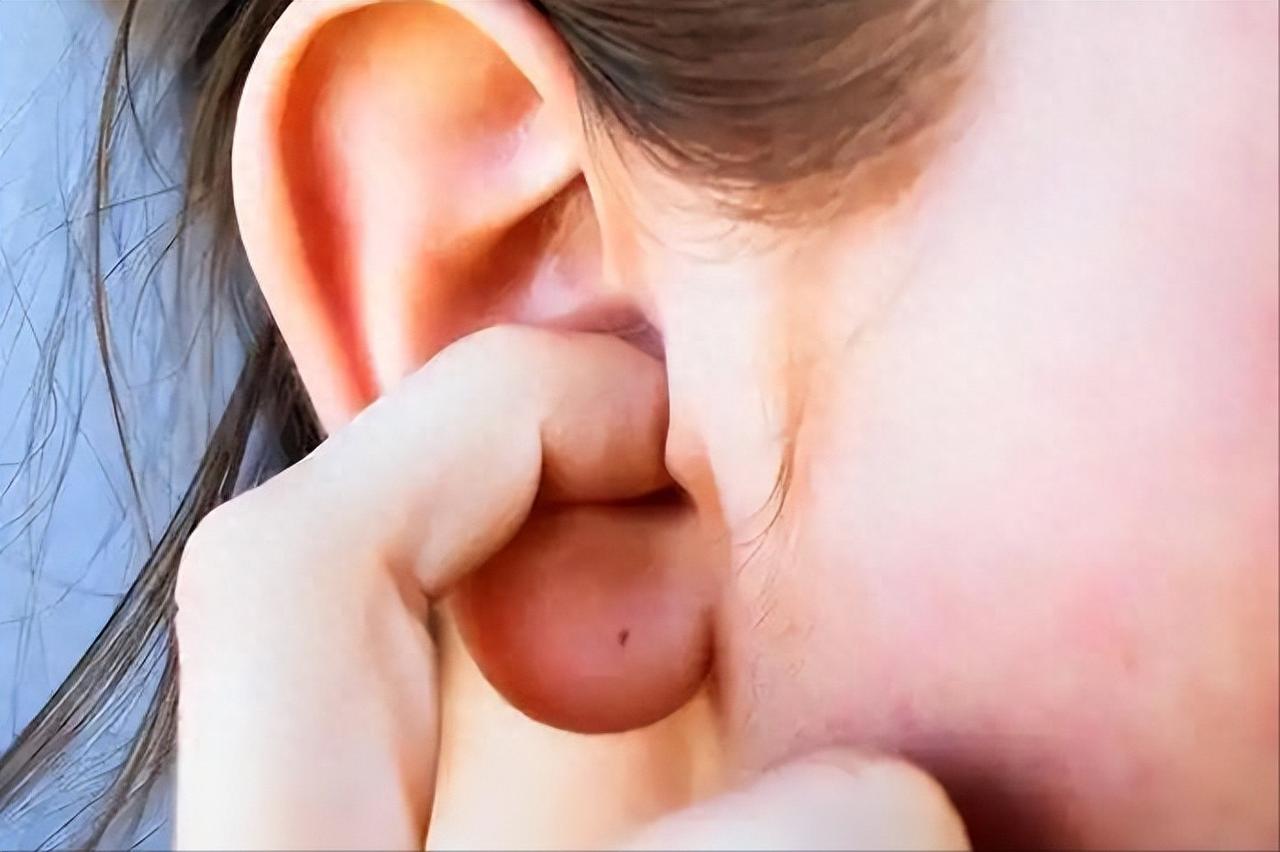 身体出问题，耳朵先知道？耳朵频繁瘙痒，或暗示4种疾病，要警惕

耳朵痒痒的事，很