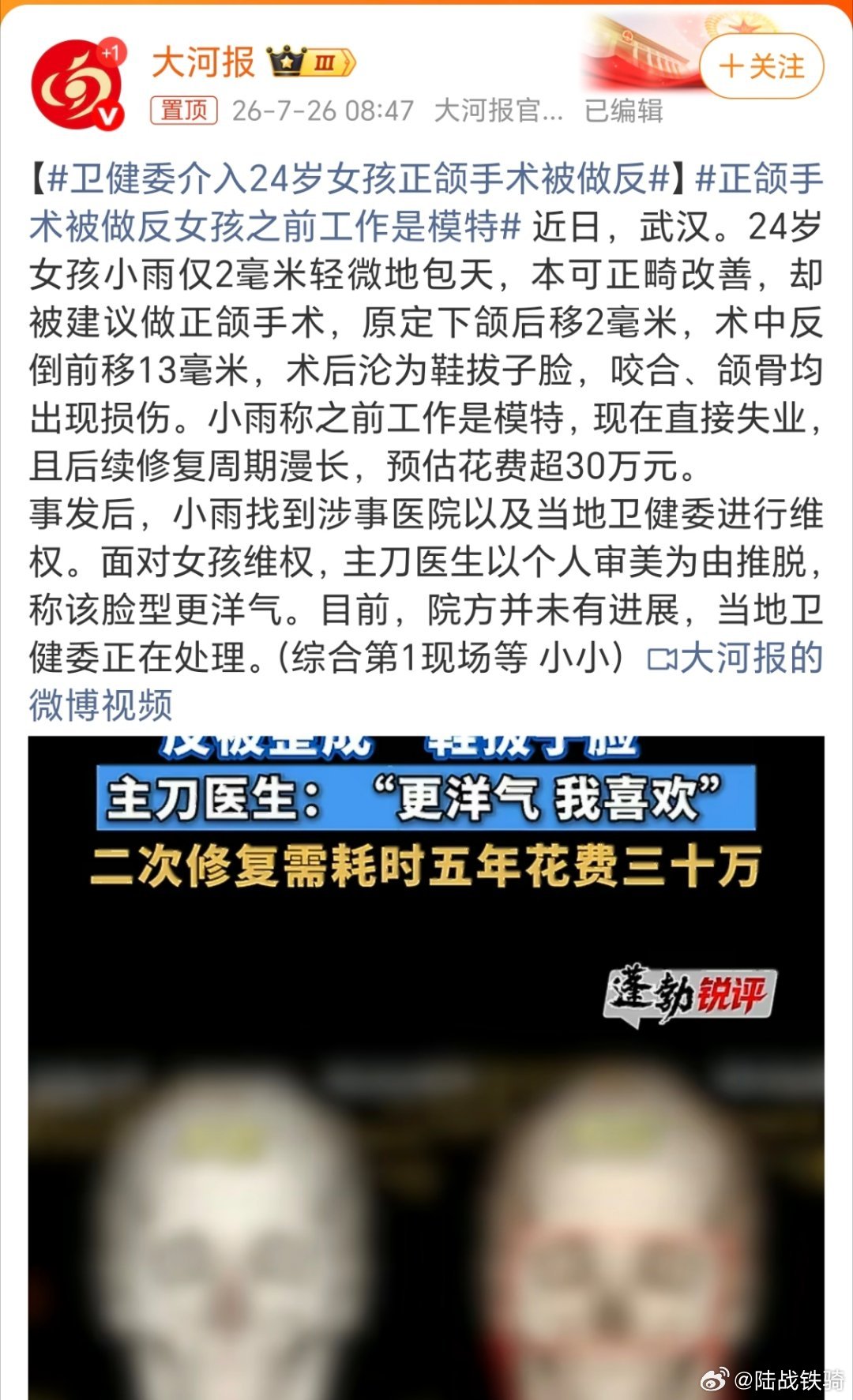 医生说鞋拔子脸更洋气？不知道医生说这话的时候，内心是不是在偷笑啊。把人家的手术给