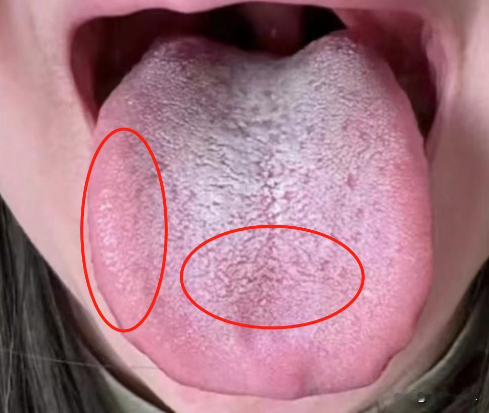 半夜总是醒，这样的情况是肺虚占主要问题！你先去疏肝没效果啊

有一个粉丝朋友看过