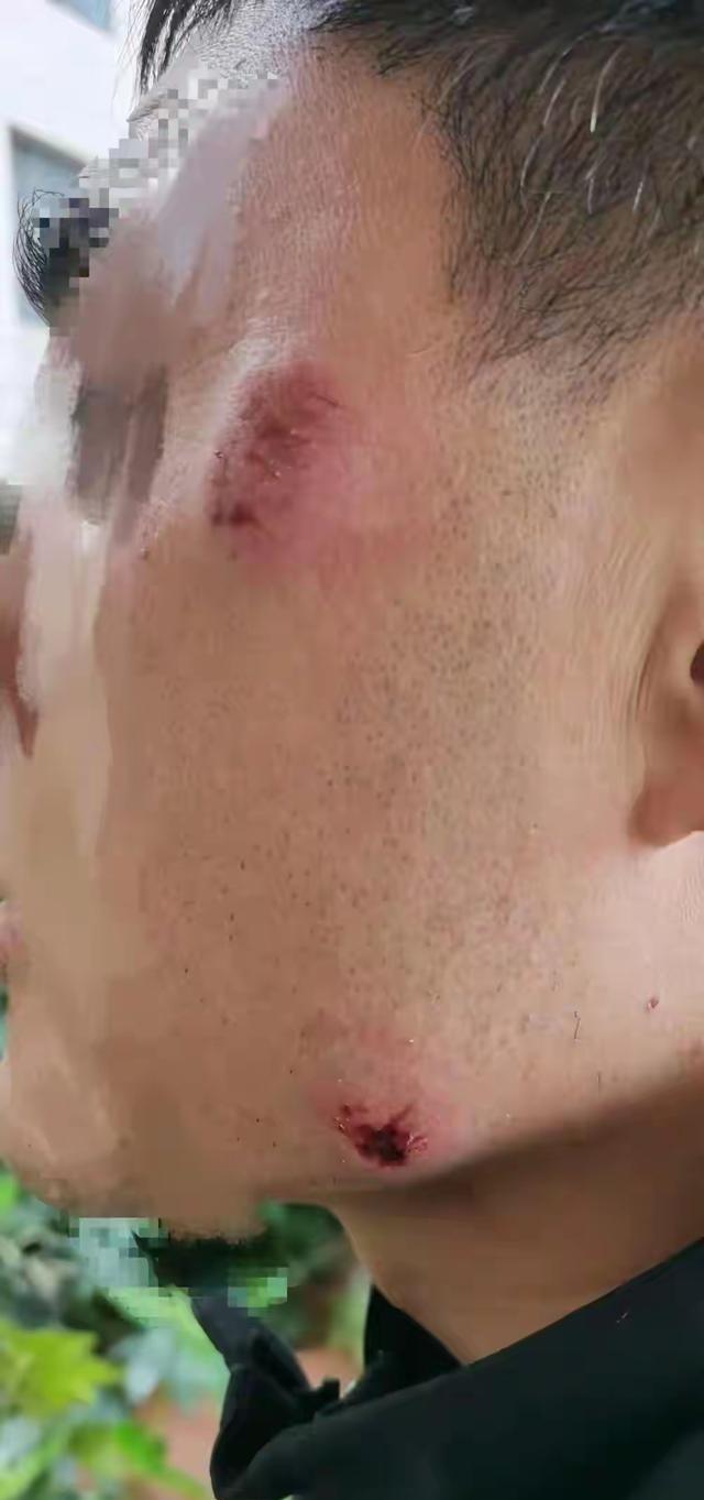 社区办公室里没人理人，

转身就挨咬还被电动车撞，

这算哪门子服务？

4月1