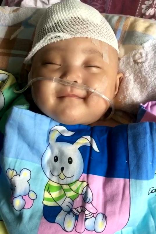 这起离奇事件发生在河南，一位50岁的张大姐在睡梦中，右肩肱骨被“震”成了七八块，