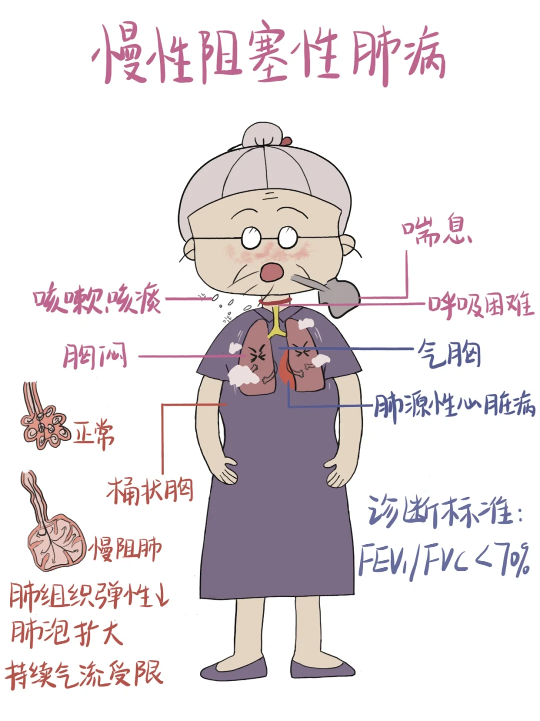 医学生笔记📒｜慢性阻塞性肺疾病🧐