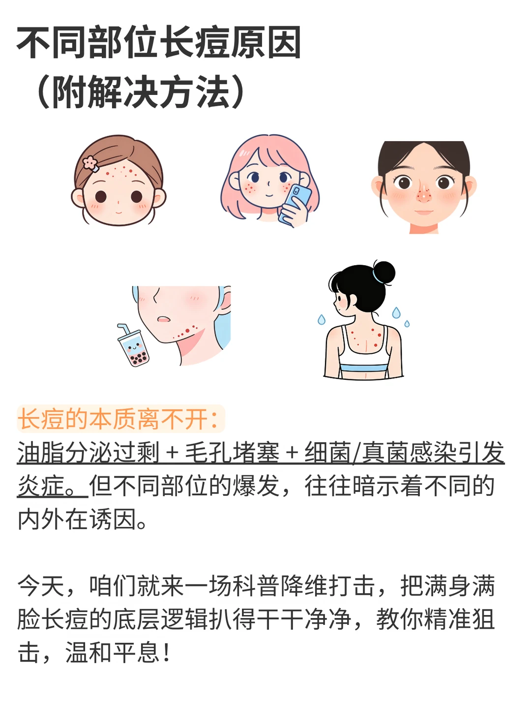 不同部位长痘原因，看这篇就够了