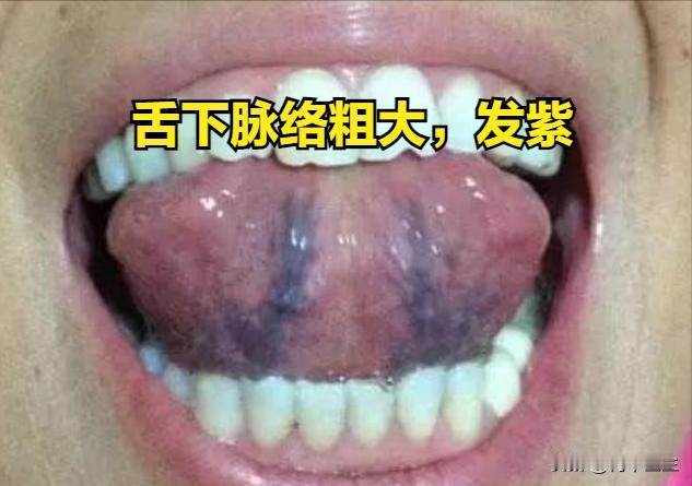 血瘀伤身，身体出现这几个症状要当心，中医教你“未病先防”

其实每年都有不少的人